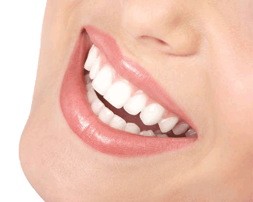 White-Smile